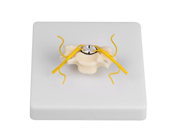 (4067) Vertebra with Spinal Cord Section