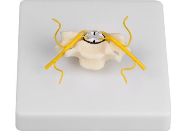 https://jayakelana.co.id/uploads/product/-4067-vertebra-with-spinal-952539f2afe432b_cover.jpg