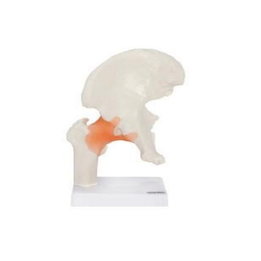 (A-105164) AXIS SCIENTIFIC FLEXIBLE HIP JOINT