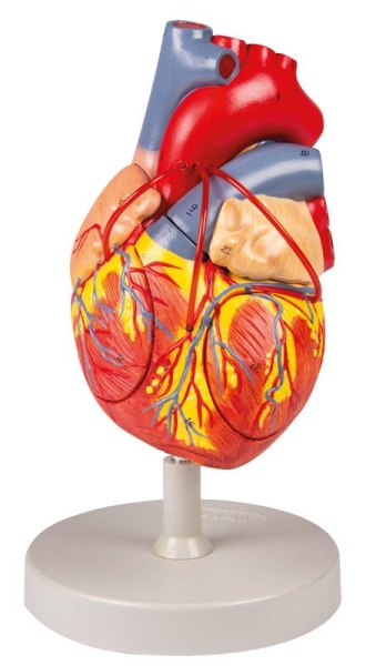(G206) Heart with Bypass, 2x life size, 2 parts