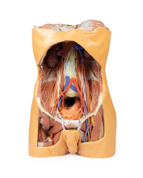 (MP1300) Posterior Abdominal Wall