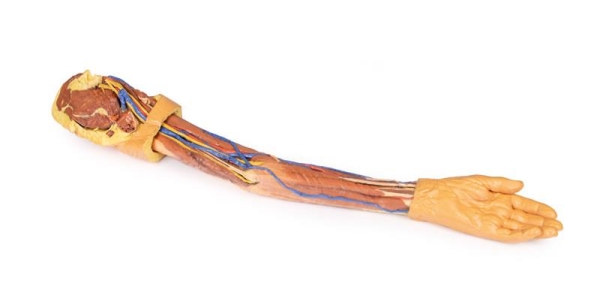 (MP1500) Upper Limb