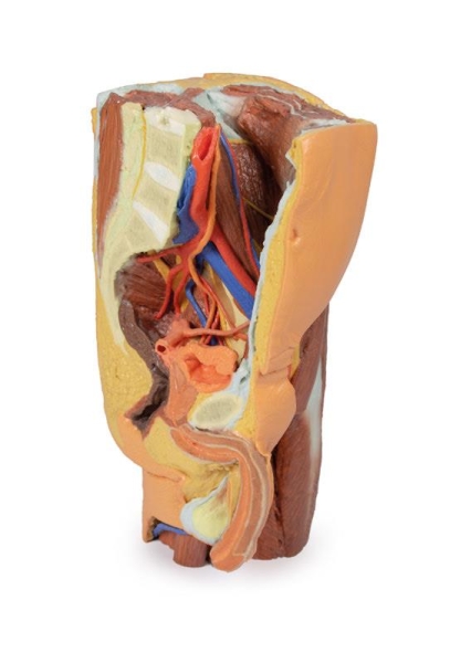 (MP1765) Male Left Pelvis and Proximal Thigh