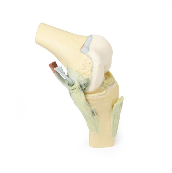 (MP1800) Knee Joint, Flexed