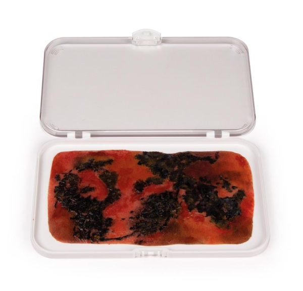 (NW008) Wound Moulage 3rd Degree Burn