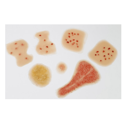 (WK160) NEWBORN SKIN/RASH WOUND KIT 