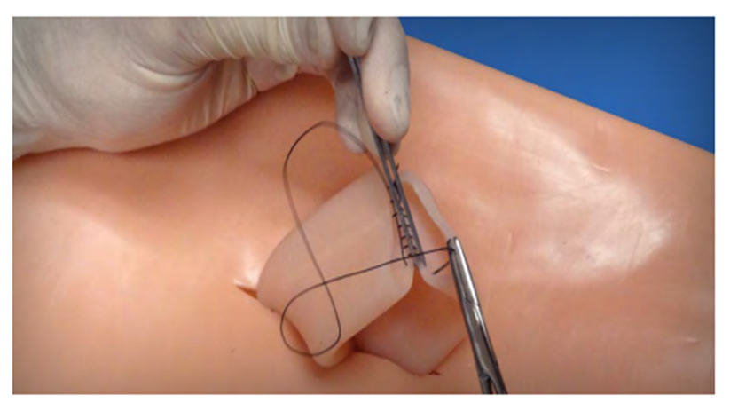(LGI-10) LARGE INTESTINE